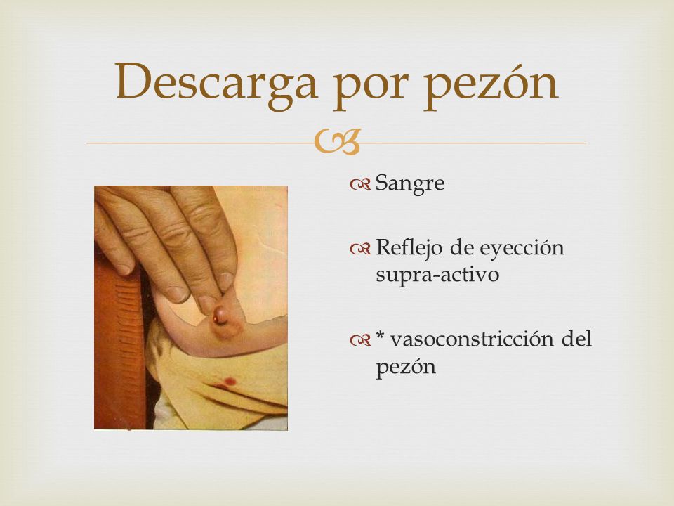 Sangre en el pezon
